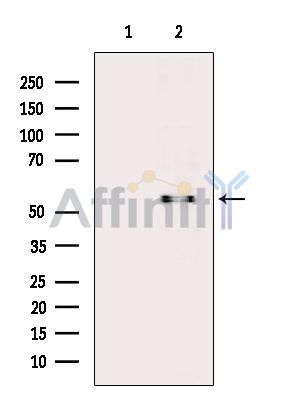 KLF11 Antibody - Western blot analysis of extracts from Rat liver, using KLF11 Antibody.