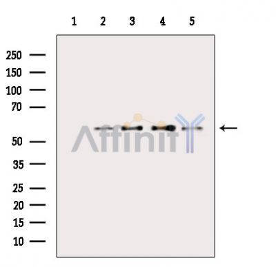 Phospho-AKT1 (Thr450) Antibody - Western blot analysis of extracts from various samples, using Phospho-AKT1 (Thr450) Antibody.