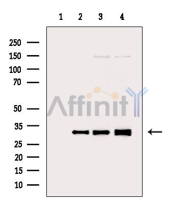 Phospho-RPS6 (Ser235) Antibody - Western blot analysis of extracts from various samples, using Phospho-RPS6 (Ser235) Antibody.