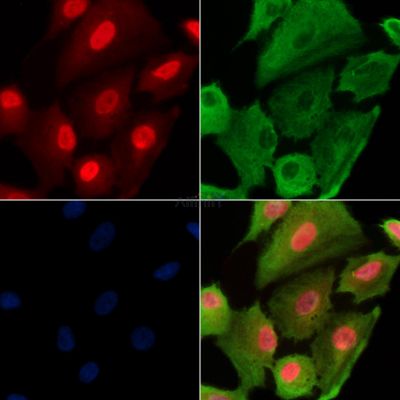 Phospho-RAD18 (Ser99) Antibody - AF3529 staining A549 cells(H2O2 treatment) by IF/ICC.