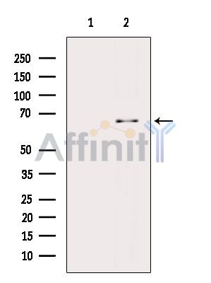 NF-kB p65 Antibody - Western blot analysis of extracts from Hela cells(LPS 4h treatment), using NF-kB p65 Antibody.