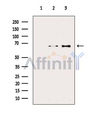 NF-kB p65 Antibody - Western blot analysis of extracts from various samples, using NF-kB p65 Antibody.