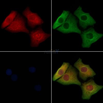 ACE1 Antibody - AF5197 staining Hela cells by IF/ICC.