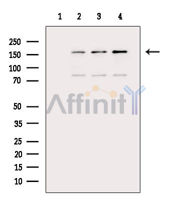 ROCK2 Antibody - Western blot analysis of extracts from various samples, using ROCK2 Antibody.