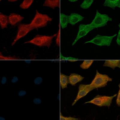 c-Met Antibody - AF6128 staining A549 cells(H2O2 treatment) by IF/ICC.