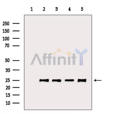 Bcl-2 Antibody - Western blot analysis of extracts from various samples, using Bcl-2 Antibody.