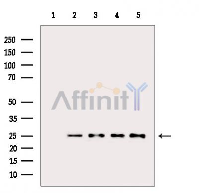 Bcl-2 Antibody - Western blot analysis of extracts from various samples, using Bcl-2 Antibody.