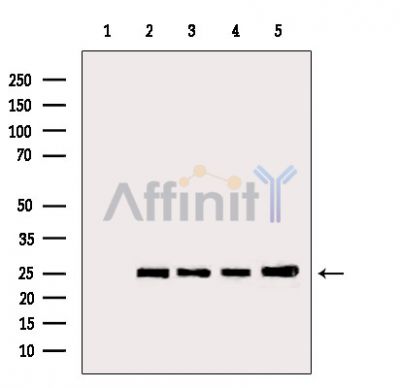 Bcl-2 Antibody - Western blot analysis of extracts from various samples, using Bcl-2 Antibody.