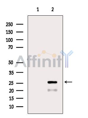 Bcl-2 Antibody - Western blot analysis of extracts from Mouse kidney, using Bcl-2 Antibody.