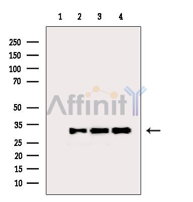 RPS6 Antibody - Western blot analysis of extracts from various samples, using RPS6 Antibody.