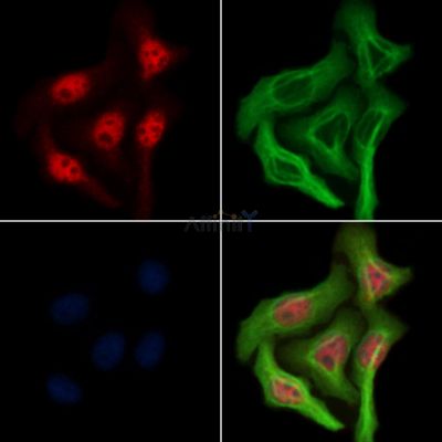 Foxp3 Antibody - AF6544 staining Hela cells by IF/ICC.