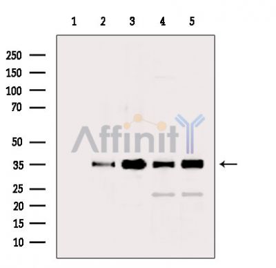 GAPDH Antibody - Western blot analysis of extracts from various samples, using GAPDH Antibody.