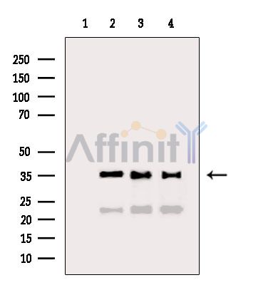 GAPDH Antibody - Western blot analysis of extracts from various samples, using GAPDH Antibody.