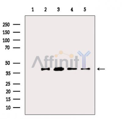 TACD2 Antibody - Western blot analysis of extracts from various samples, using TACD2 Antibody.