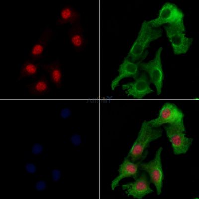 ZNF541 Antibody - DF3428 staining Hela cells by IF/ICC.