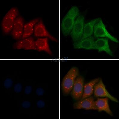CST11 Antibody - DF3975 staining Hela cells by IF/ICC.