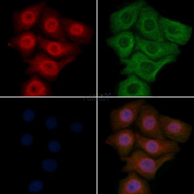HNRCL Antibody - DF4115 staining Hela cells by IF/ICC.