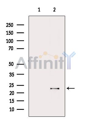 IL18 Antibody - Western blot analysis of extracts from Mouse kidney, using IL18 Antibody.