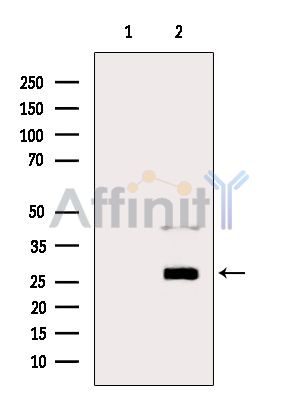 PRSS1 Antibody - Western blot analysis of extracts from B16F10 cells(serum starvation treatment), using PRSS1 Antibody.