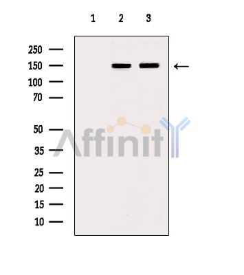 DCTN1 Antibody - Western blot analysis of extracts from various samples, using DCTN1 Antibody.