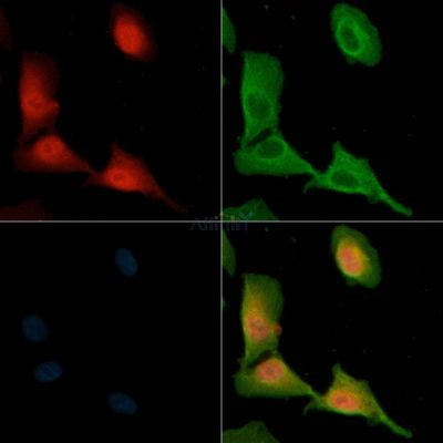 TP53 Antibody - DF7238 staining A549 cells(H2O2 treatment) by IF/ICC.