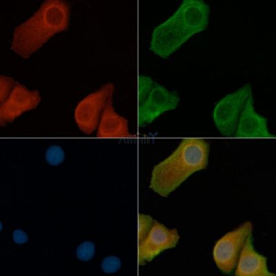 MIB1 Antibody - DF8340 staining Hela cells by IF/ICC.