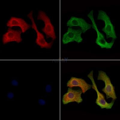 IgA Antibody - DF8563 staining Hela cells by IF/ICC.