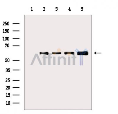 Phospho-AKT1 (Thr450) Antibody - Western blot analysis of extracts from various samples, using Phospho-AKT1 (Thr450) Antibody.
