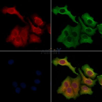 MMP9 Antibody - AF5228 staining Hela cells by IF/ICC.