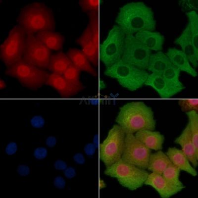 SQSTM1/p62 Antibody - AF5384 staining Hela cells by IF/ICC.