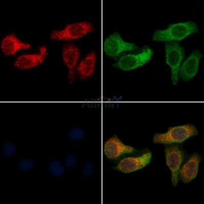 Transferrin Receptor Antibody - AF6896 staining Hela cells by IF/ICC.