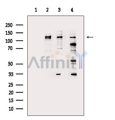 NLRP3 Mouse monoclonal Antibody - Western blot analysis of extracts from various samples, using NLRP3 Mouse monoclonal Antibody.