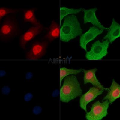 NFE2 Antibody - DF2595 staining Hela cells by IF/ICC.