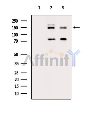 Phospho-TSC1 (Ser505) Antibody - Western blot analysis of extracts from various samples, using Phospho-TSC1 (Ser505) Antibody.