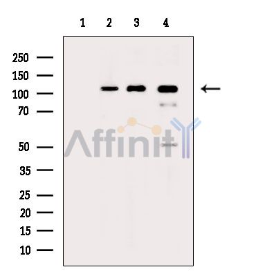 Phospho-NEDD4 (Ser670) Antibody - Western blot analysis of extracts from various samples, using Phospho-NEDD4 (Ser670) Antibody.