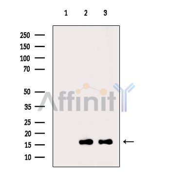 Acetyl-Histone H2A (Lys5) Antibody - Western blot analysis of extracts from various samples, using Acetyl-Histone H2A (Lys5) Antibody.