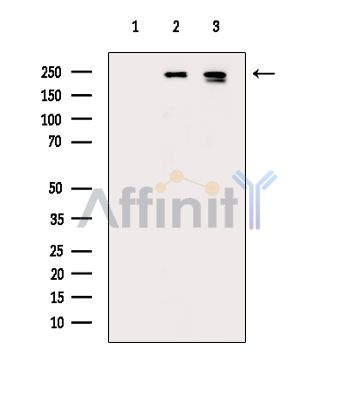 Phospho-Tuberin/TSC2 (Ser664) Antibody - Western blot analysis of extracts from various samples, using Phospho-Tuberin/TSC2 (Ser664) Antibody.