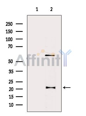 DHFR Antibody - Western blot analysis of extracts from Mouse liver, using DHFR Antibody.