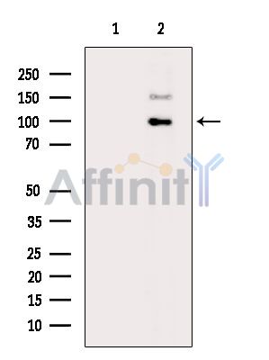 Phospho-CYLD (Ser422) Antibody - Western blot analysis of extracts from HepG2 cells(heat-shock treatment), using Phospho-CYLD (Ser422) Antibody.