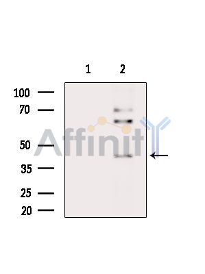 Phospho-PAR4 (Thr163) Antibody - Western blot analysis of extracts from HepG2 cells(heat-shock treatment), using Phospho-PAR4 (Thr163) Antibody.