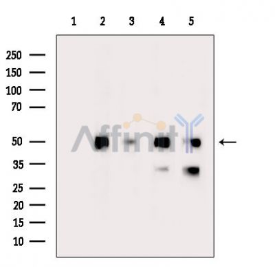 alpha Tubulin Antibody - Western blot analysis of extracts from various samples, using alpha Tubulin Antibody.