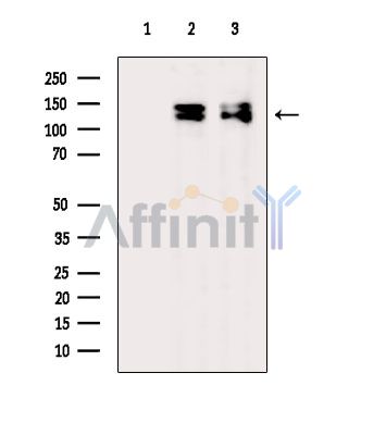 Eg5 Antibody - Western blot analysis of extracts from various samples, using Eg5 Antibody.