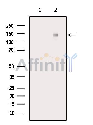 BACH1/BRIP1 Antibody - Western blot analysis of extracts from RAW264.