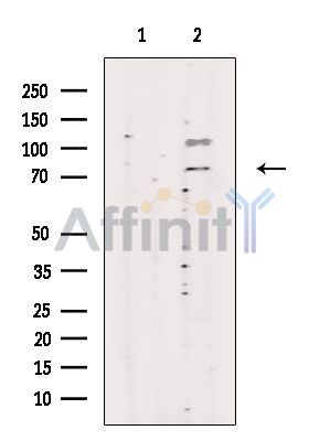 SRPK2 Antibody - Western blot analysis of extracts from Rat testis, using SRPK2 Antibody.