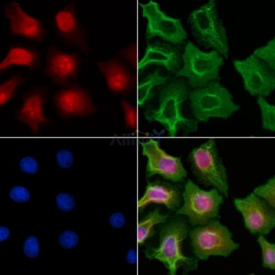 CDY1 Antibody - DF10090 staining HepG2 cells by IF/ICC.