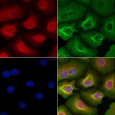 HCG2040518 Antibody - DF10307 staining HepG2 cells by IF/ICC.