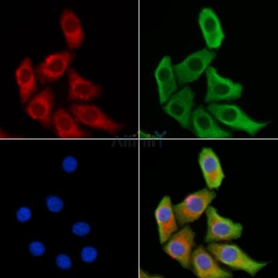 RSAD2 Antibody - DF12227 staining HepG2 cells by IF/ICC.