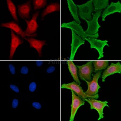 VGLL2 Antibody - DF2251 staining HepG2 cells by IF/ICC.