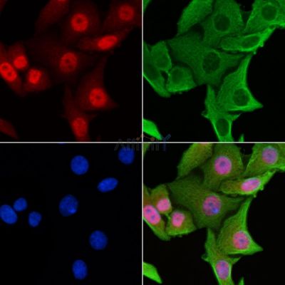 CENPL Antibody - DF2313 staining HepG2 cells by IF/ICC.
