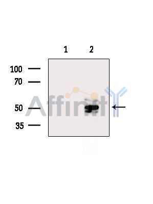 DMRTB1 Antibody - Western blot analysis of DMRTB1 expression in  mouse testis.